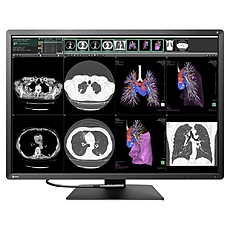 Медицински монитор EIZO RadiForce RX1270 12MP Цветен
